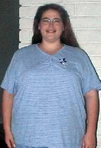 before photo