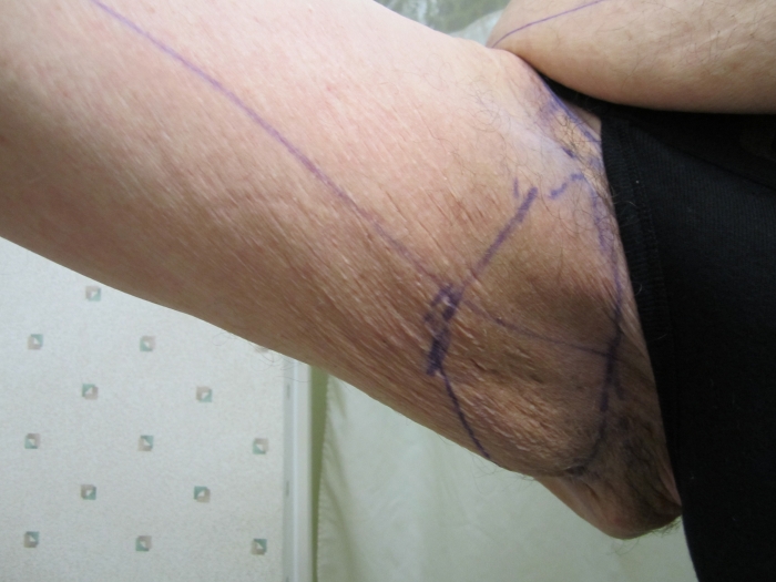http://images.obesityhelp.com/uploads/org_profile/6762/albums/99916/014.JPG