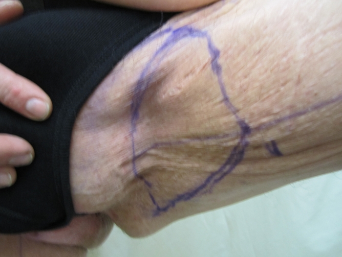 http://images.obesityhelp.com/uploads/org_profile/6762/albums/99916/016.JPG