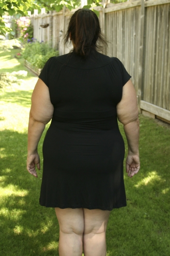View more of my photos at ObesityHelp.com