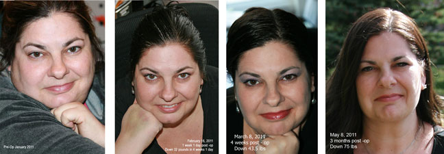 View more of my photos at ObesityHelp.com