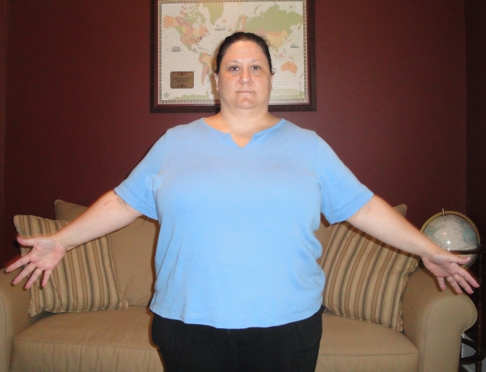 View more of my photos at ObesityHelp.com