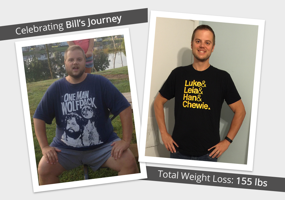 Before & After RNY with Bill! : ObesityHelp