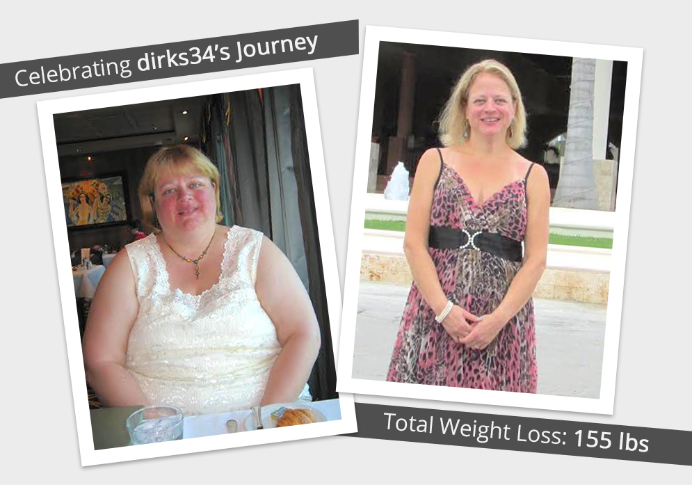 Before & After RNY with dirks34! : ObesityHelp