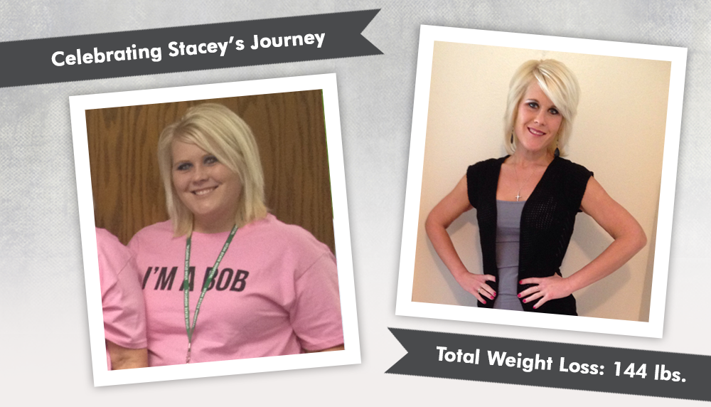 Before & After RNY with Stacey, losing 144 lbs! ObesityHelp
