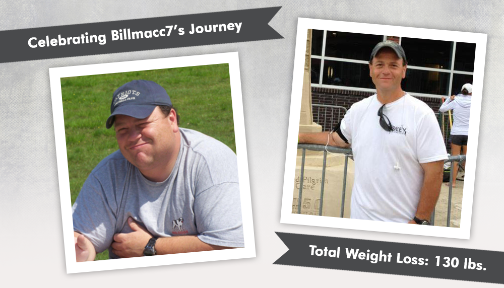 Before & After RNY with Billmacc7 : ObesityHelp