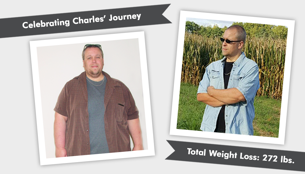 Before & After VSG with Charles 272 Pounds Lost! ObesityHelp