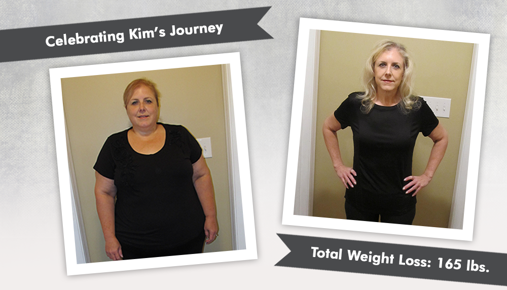 Before & After DS with Kim's 165 Pound Weight Loss! ObesityHelp