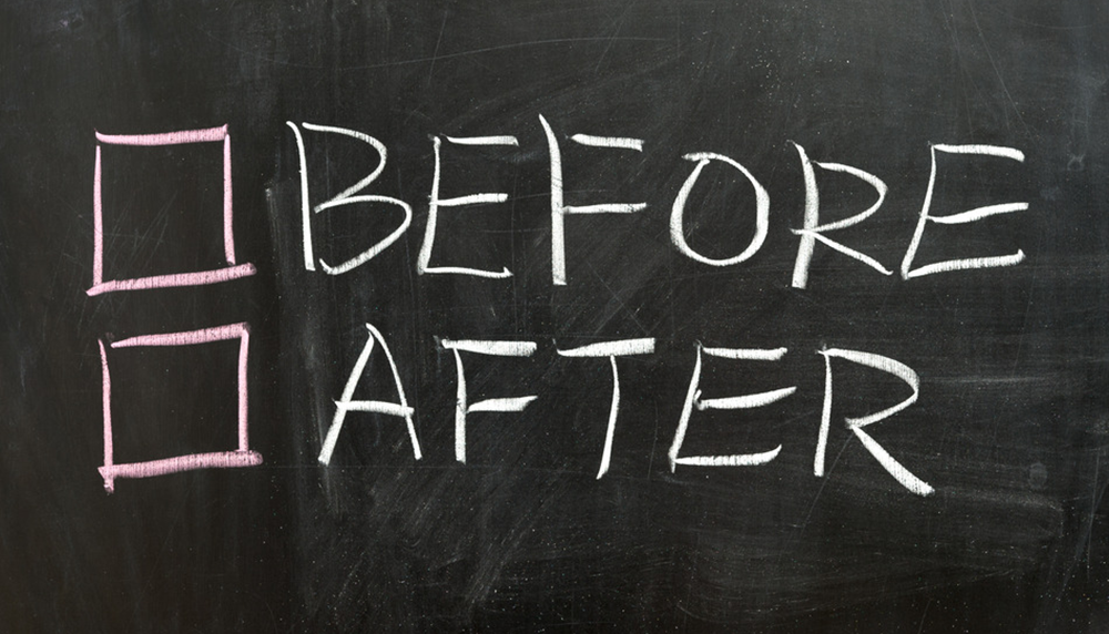 After the After - ObesityHelp.com : ObesityHelp