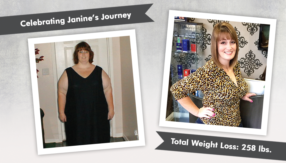 Before & After RNY with Janine! : ObesityHelp