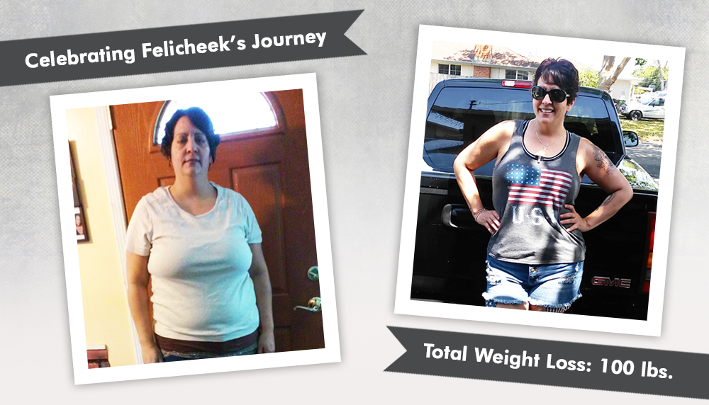 Before & After VSG Sleeve with Felicheeks ObesityHelp