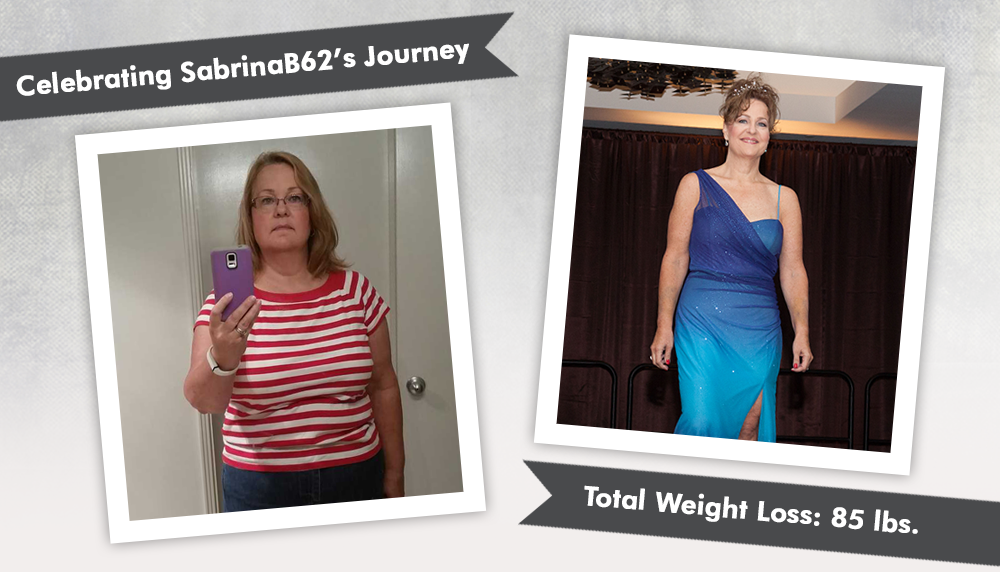 Before & After RNY with SabrinaB62 : ObesityHelp