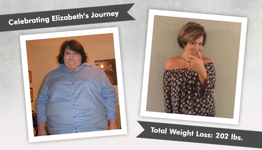 Before & After VSG with Elizabeth, losing 202 lbs! ObesityHelp