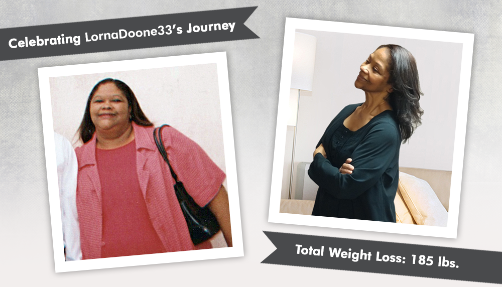 Before & After RNY with LornaDoone33, losing 185 pounds! ObesityHelp