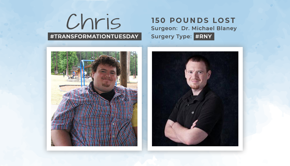 Before & After RNY with Chris, losing 150 pounds! ObesityHelp