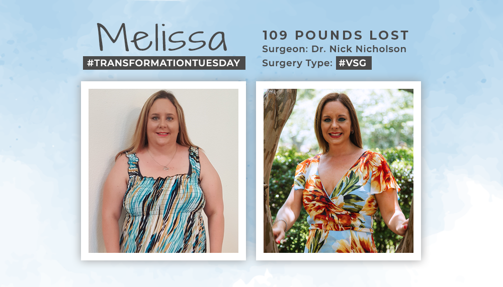 Before & After VSG with Melissa, losing 109 lbs! ObesityHelp