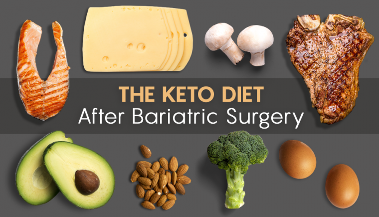 ketogenic diet after bariatric surgery