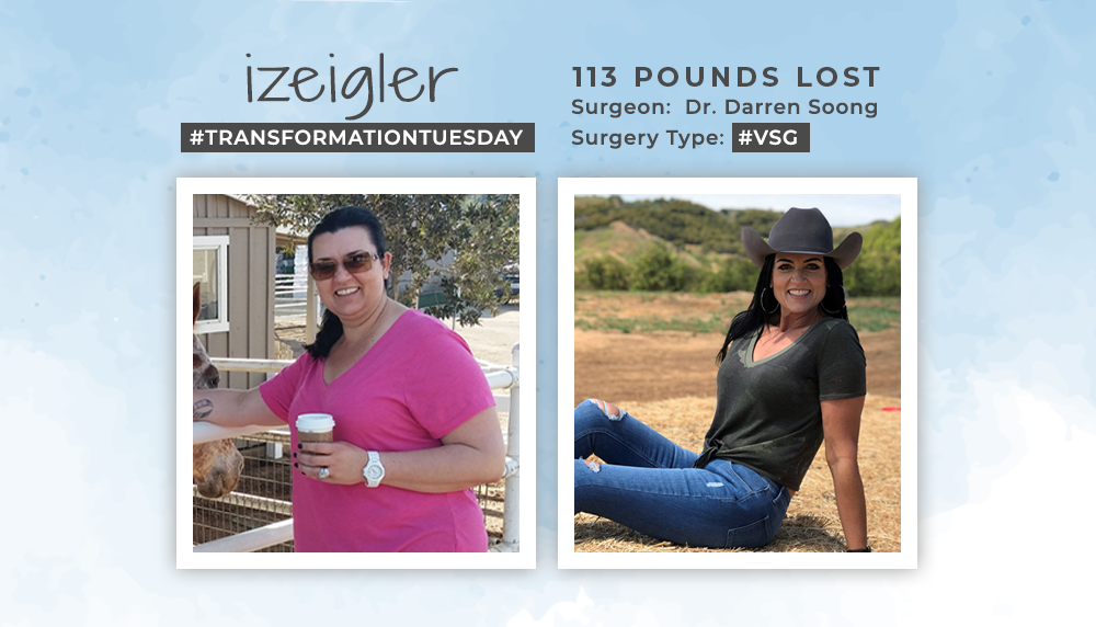 Before & After VSG with izeigler, losing 113 pounds! ObesityHelp