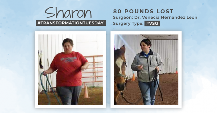 Before & After VSG with Sharon