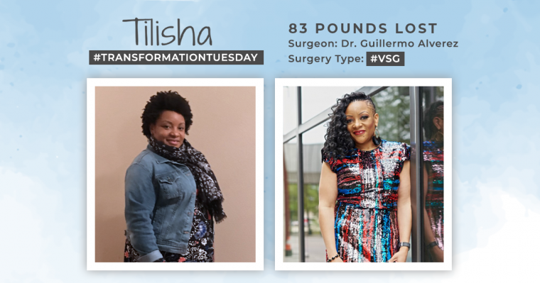 Before & After VSG with Tilisha