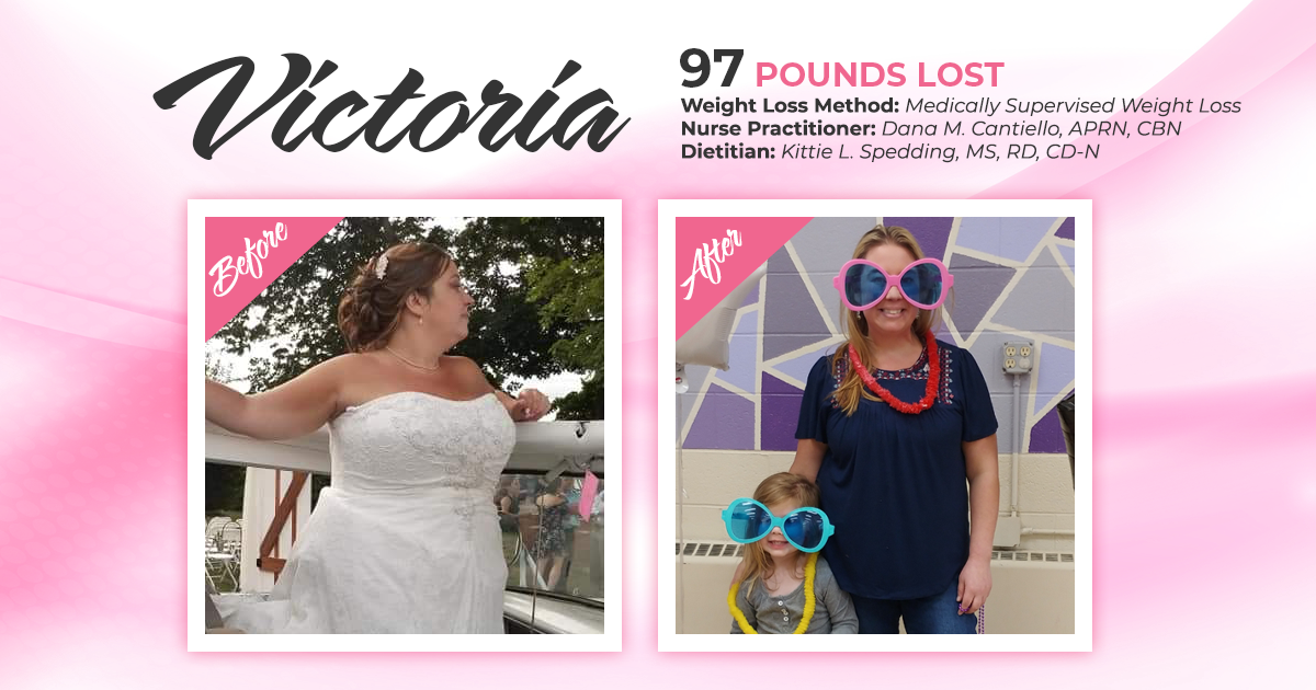 Before And After Medically Supervised Weight Loss With Victoria Down 97