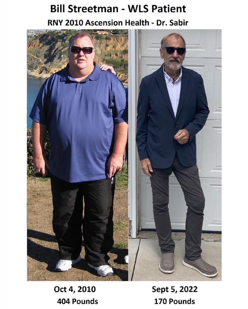 Bill's Weight Loss Story